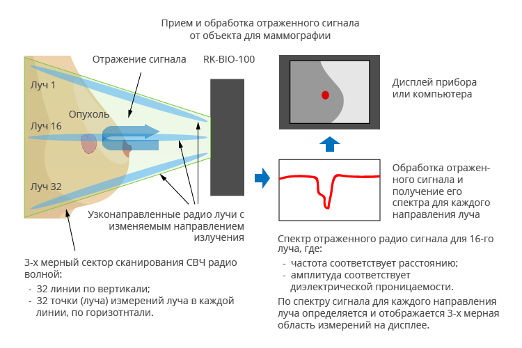 NEURON для дистанционной маммографии